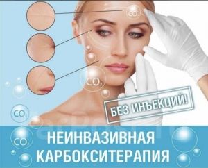 Карбоксітерапія